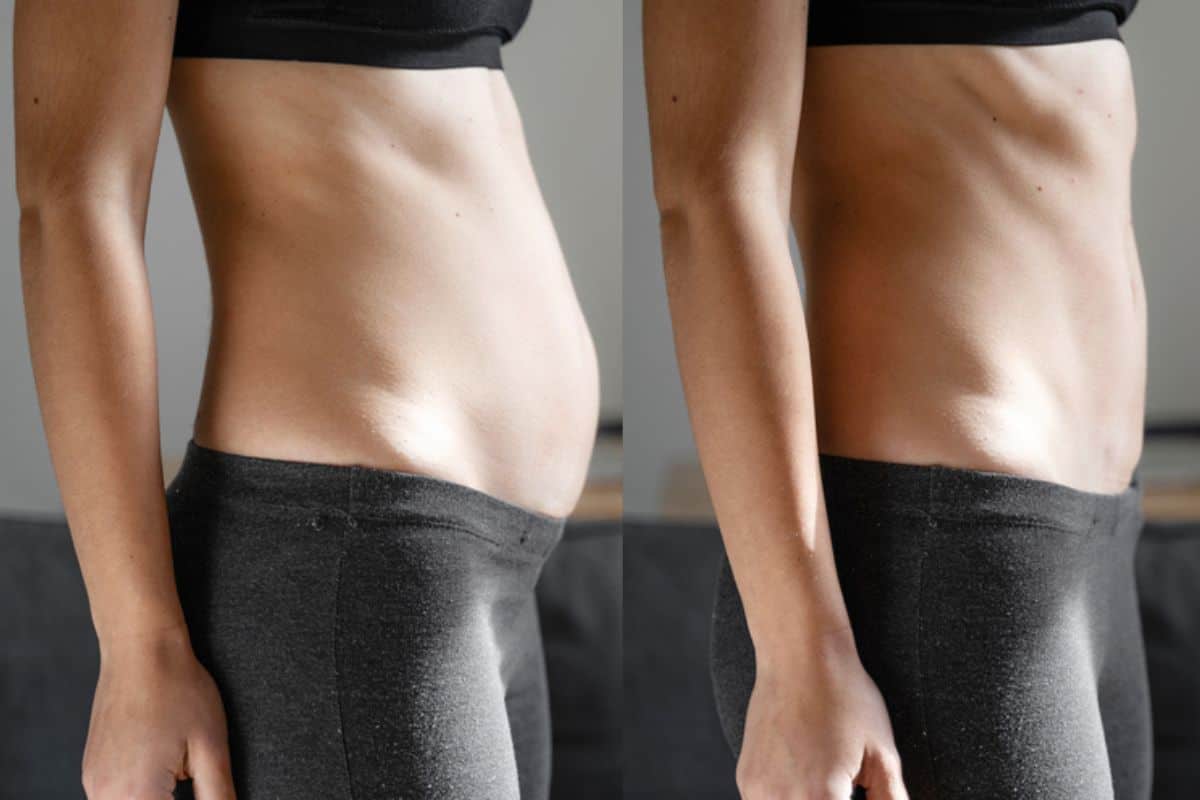 Post-Pregnancy: What Happens to Your Abdominal Muscles After Birth East Kilbride