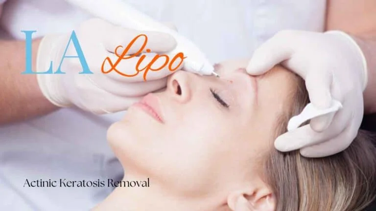 Woman receiving Actinic Keratosis Removal Treatment East Kilbride