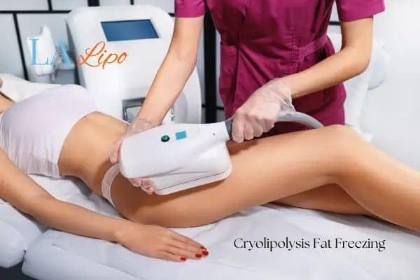 Woman receiving coolsculpting East Kilbride treatment on her thighs