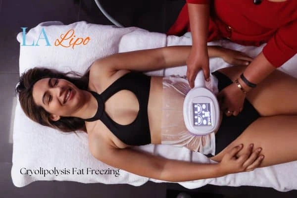 woman getting cryolipolysis East Kilbride