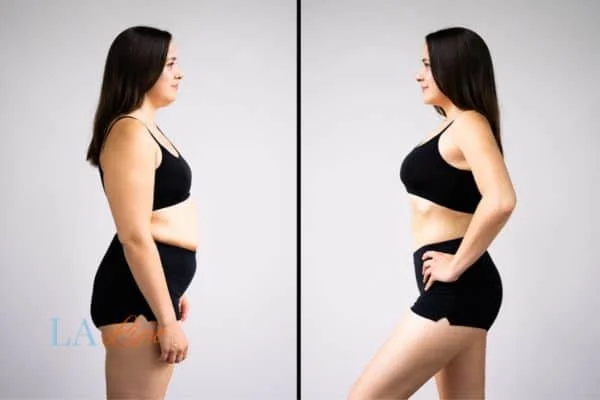 link between body image and mental health East Kilbride