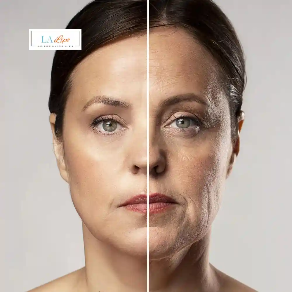 How Can You Tell If Non-Surgical Skin Tightening Is Right for You East Kilbride?