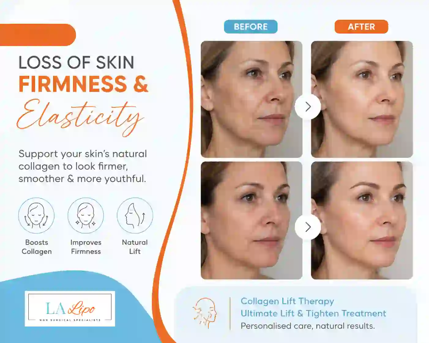 Sign #7: Loss of Skin Firmness and Elasticity East Kilbride
